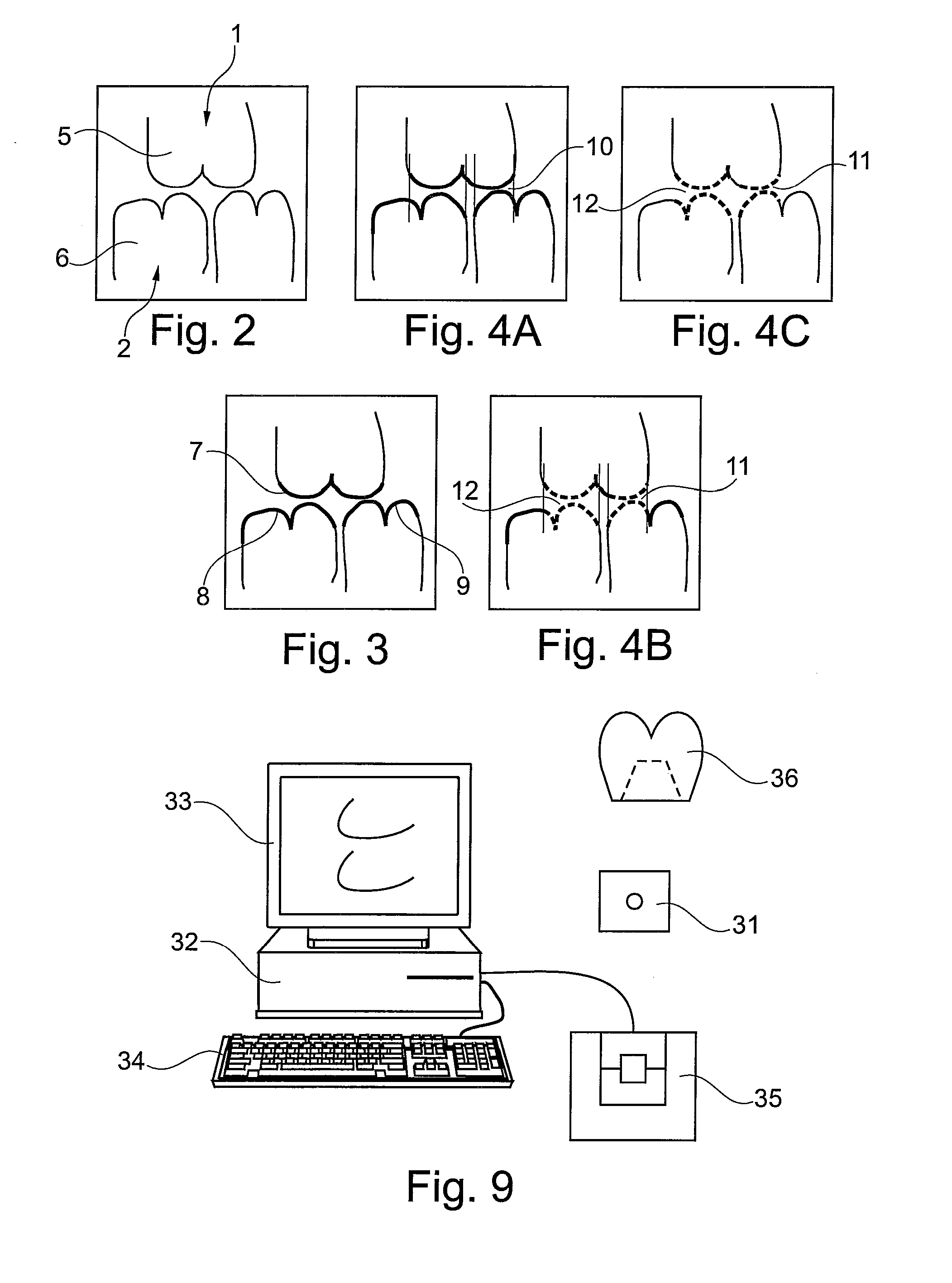 Method for constructing tooth surfaces of a dental prosthesis and for producing dental restorations