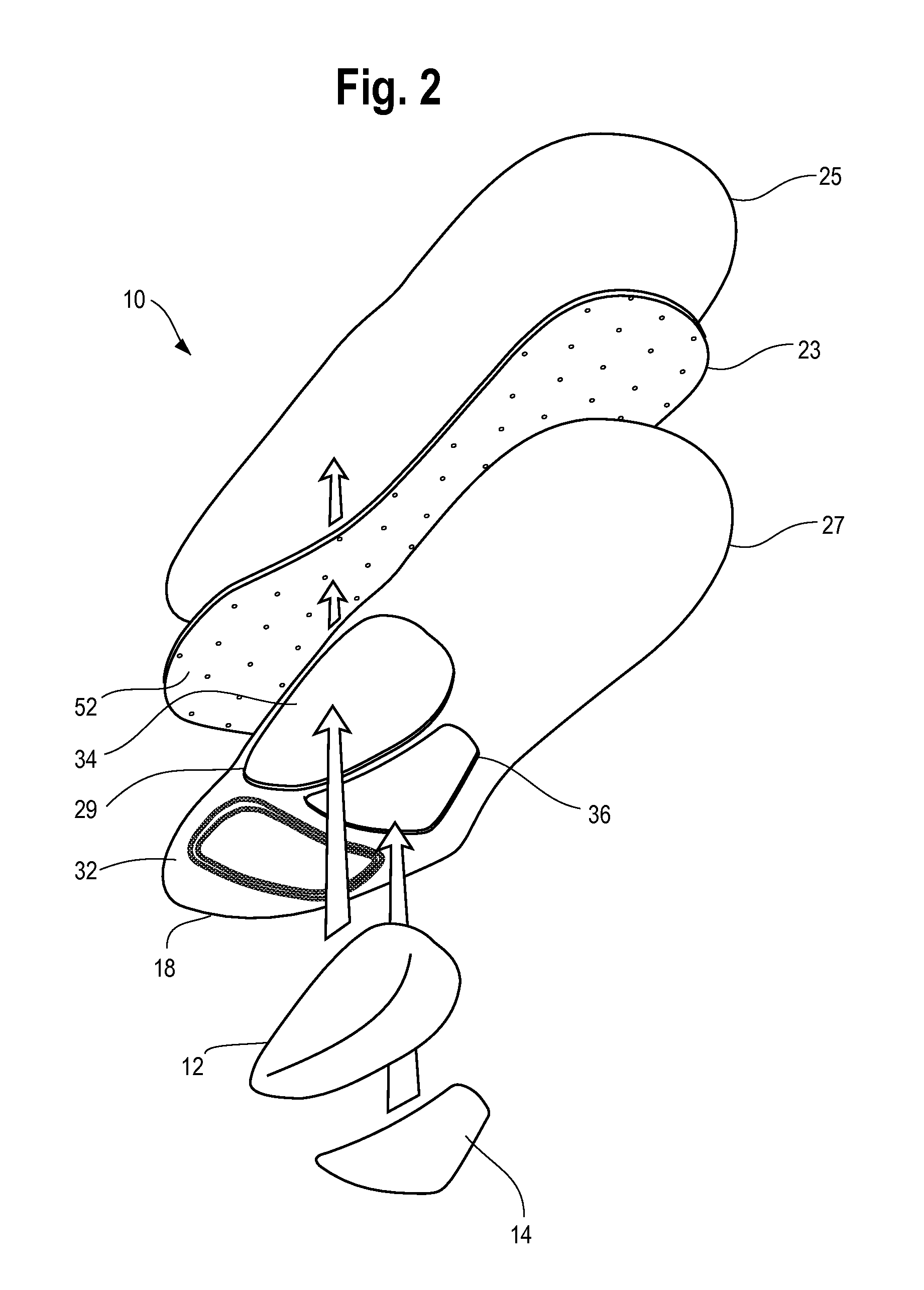 Orthotic foot device with removable support components and method of making same