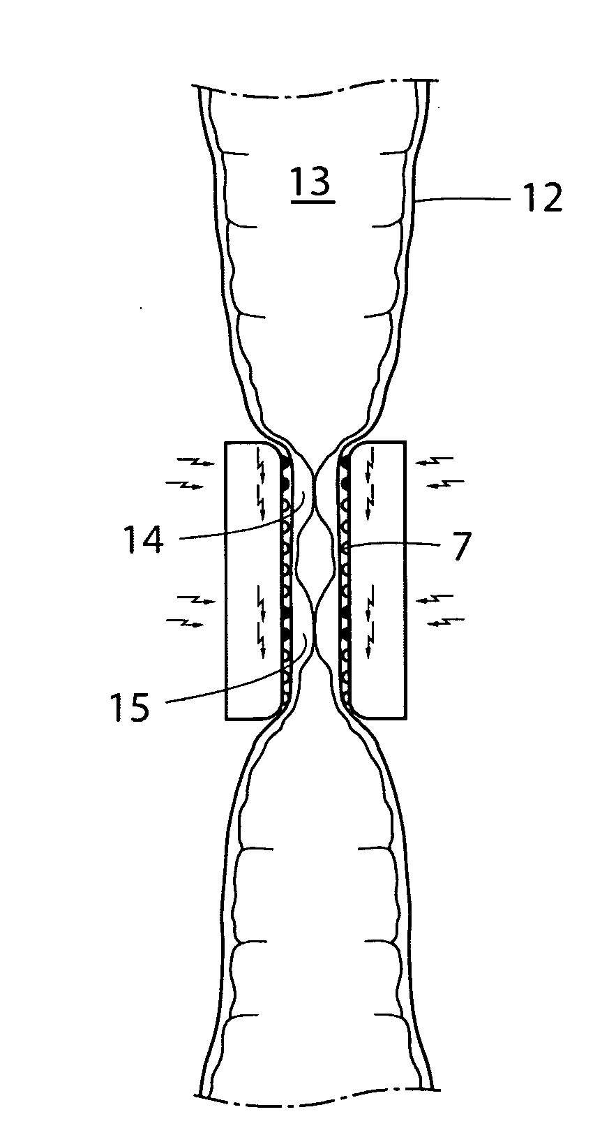 Method of obtaining male contraception