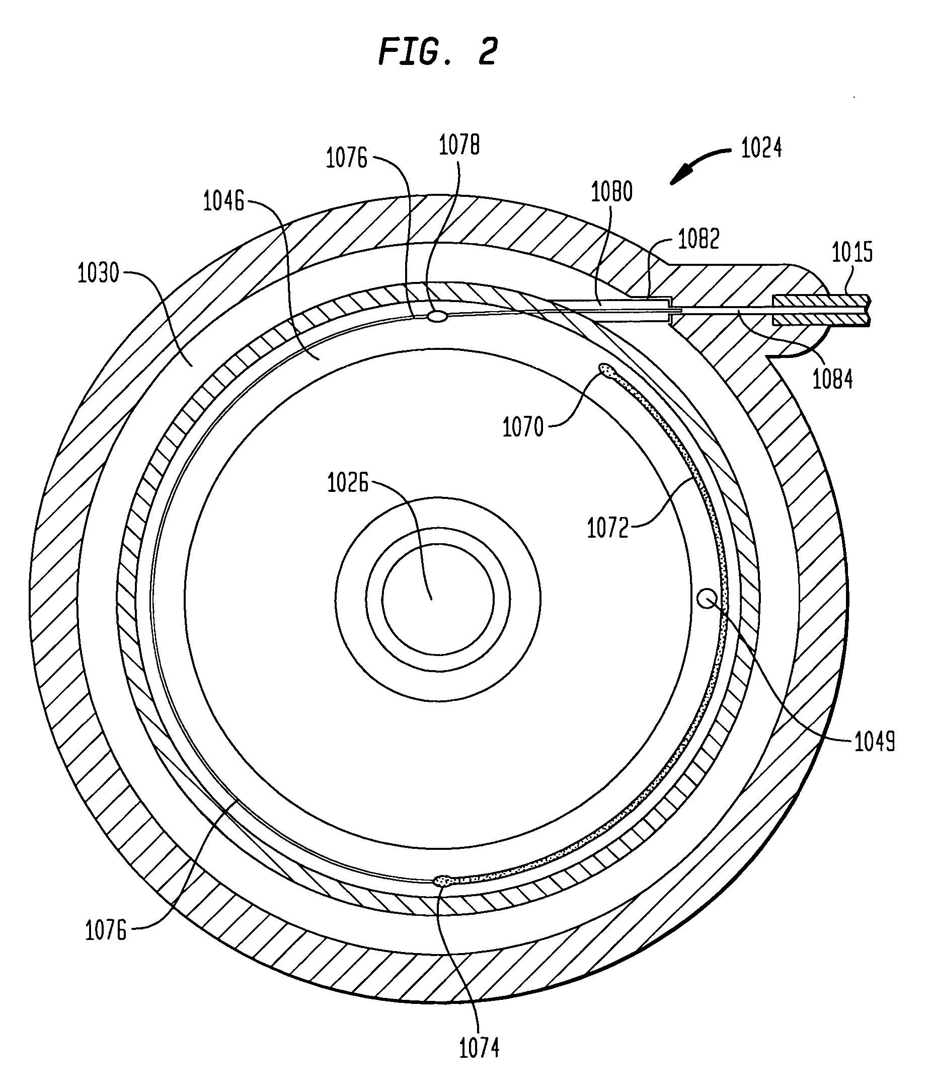 Implantable pump with infinitely variable resistor