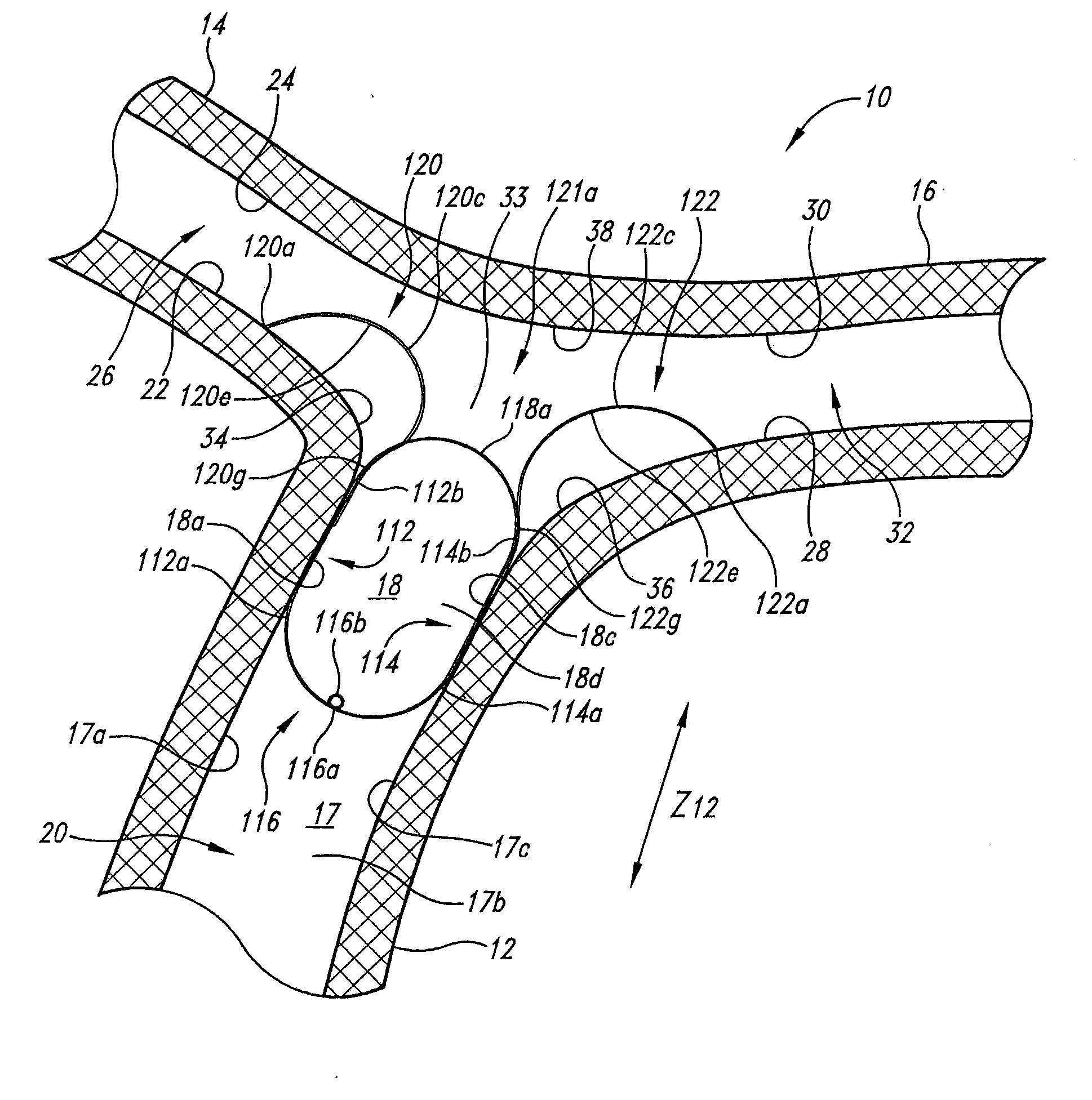 Vascular anchoring system and method