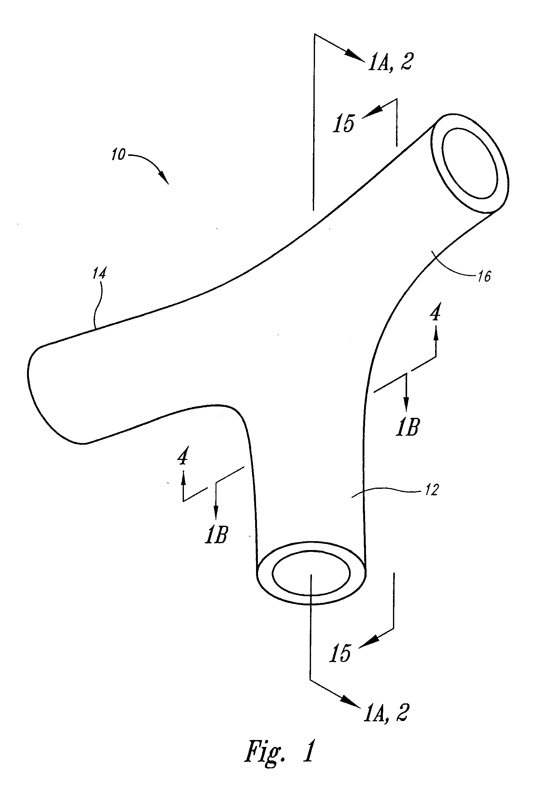 Vascular anchoring system and method