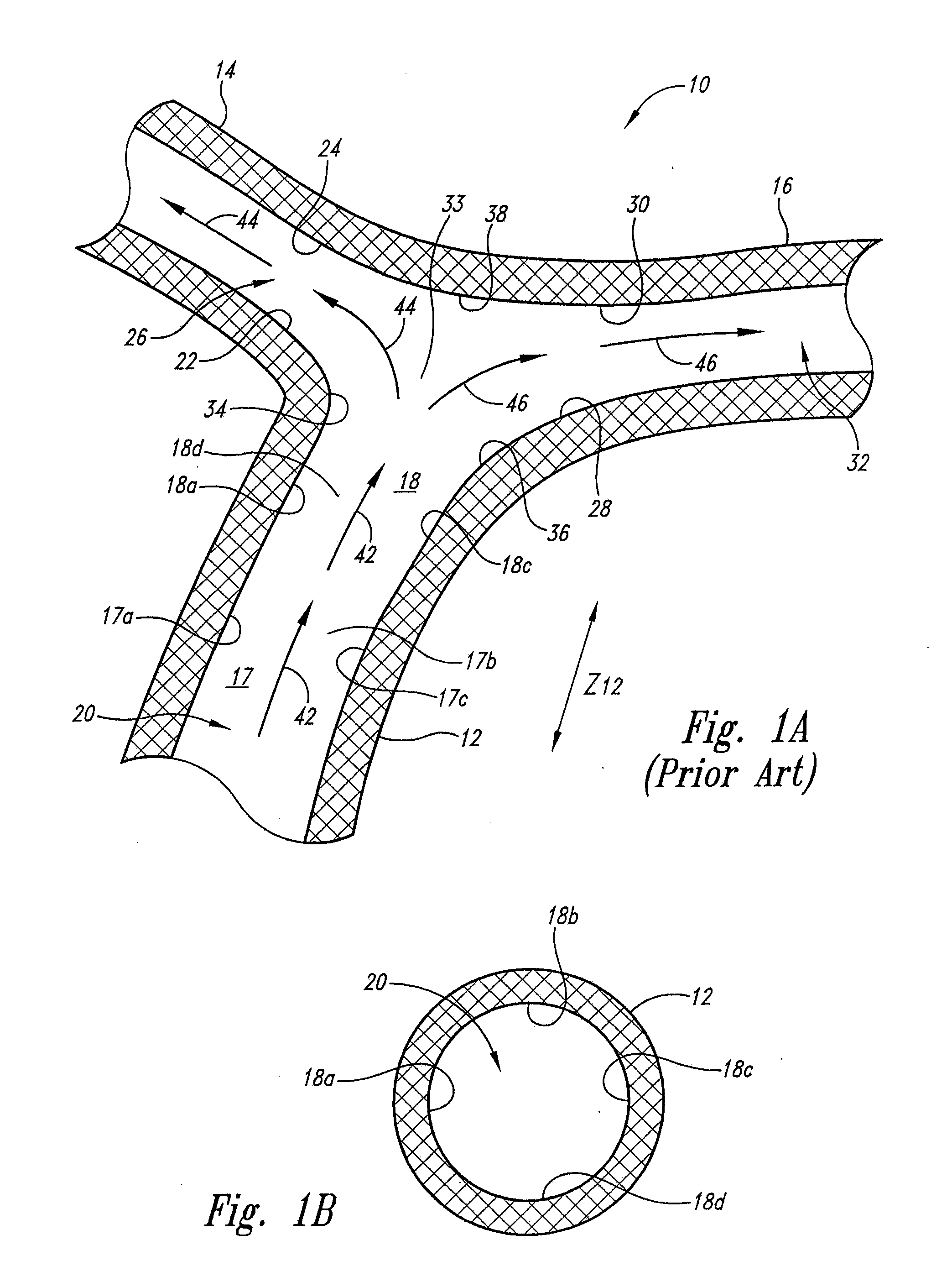 Vascular anchoring system and method