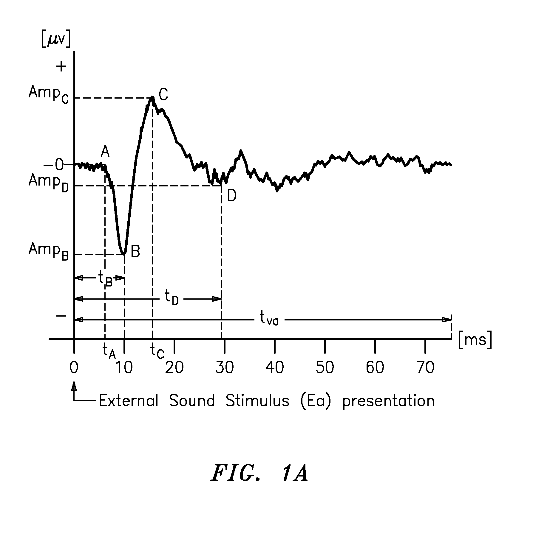 Method and apparatus for obtaining and registering an electrical cochlear response ("ecr")