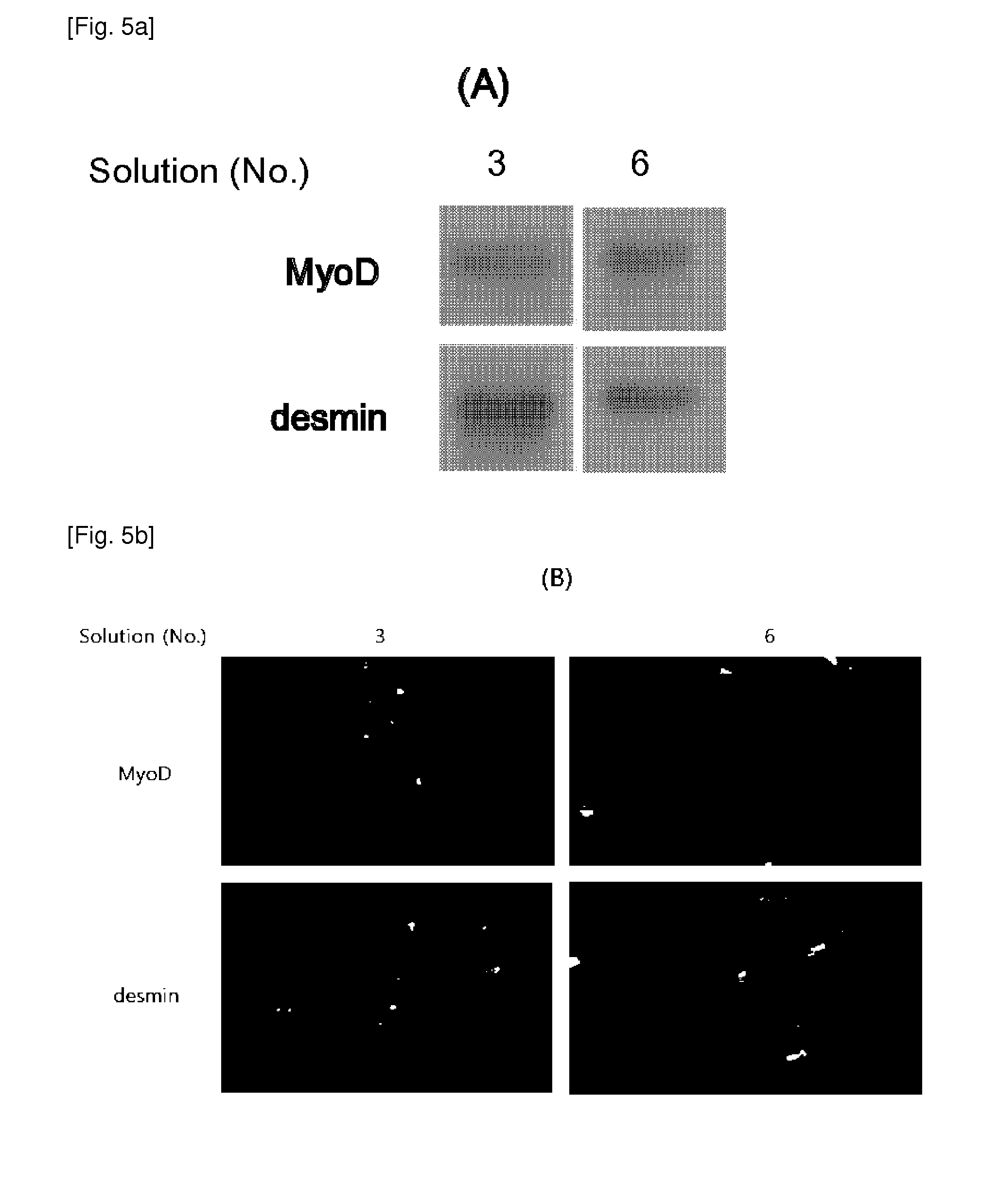 Freezing medium composition for cryopreserving amniotic fluid-derived stem cells and a method for cryopreserving the same