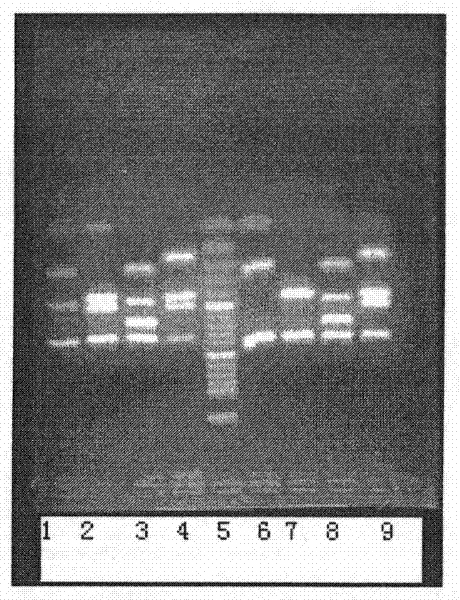 A genetic detection method for y-chromosome microdeletion