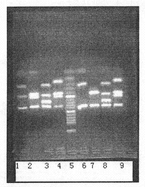 A genetic detection method for y-chromosome microdeletion