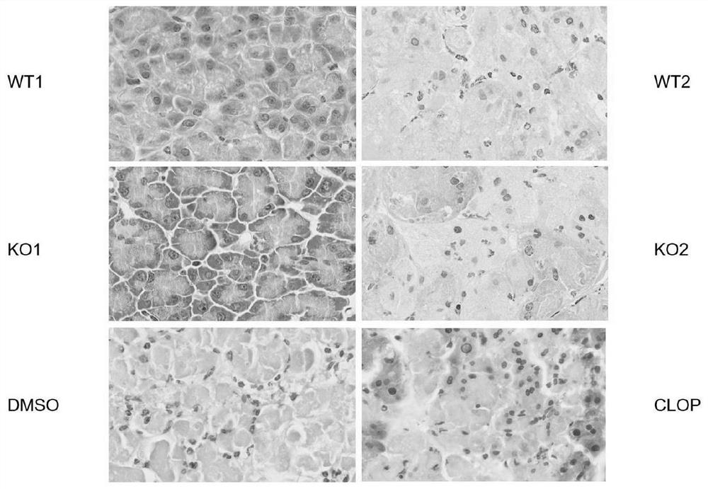 Application of P2Y12 receptor and antagonist thereof in diagnosis and treatment of acute pancreatitis