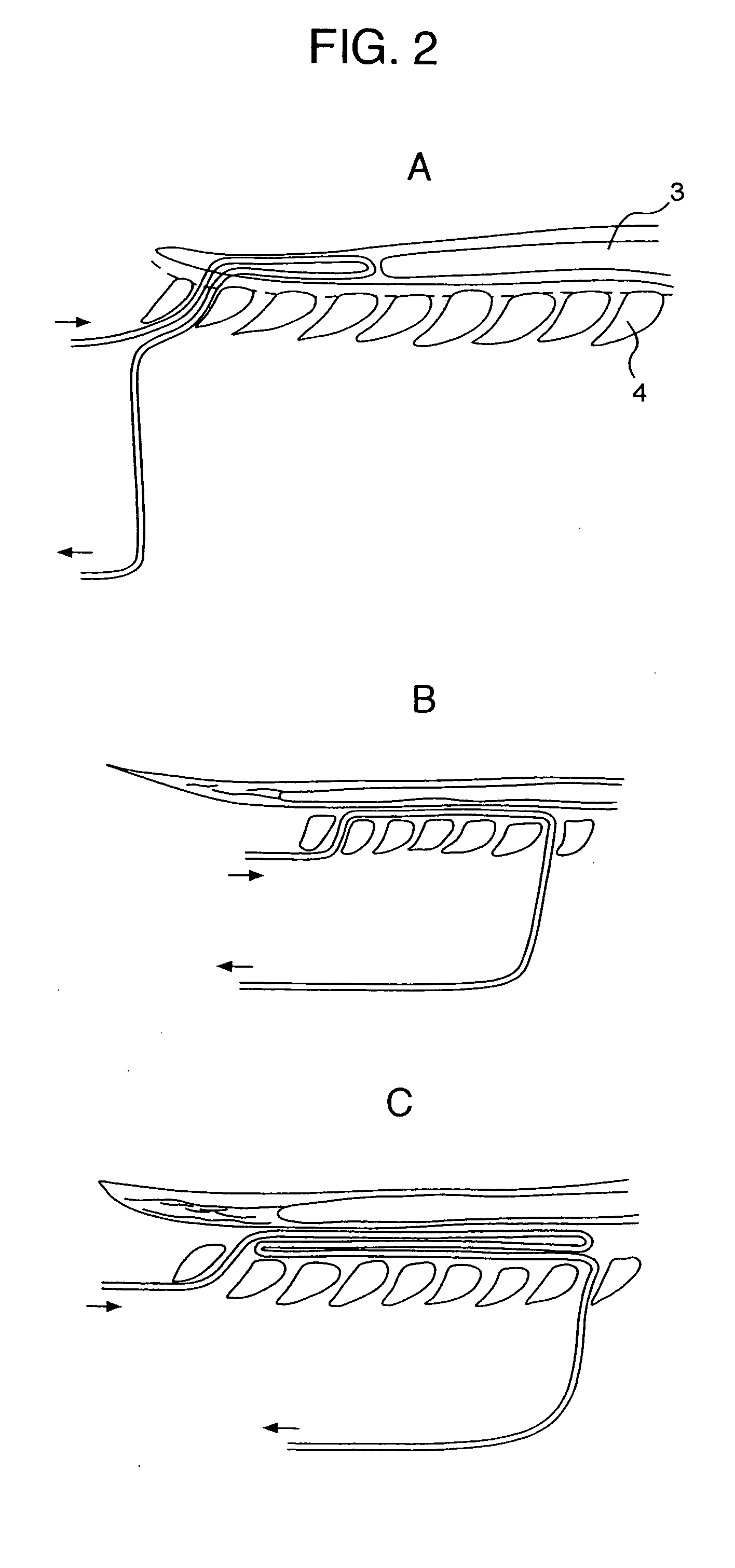 Catheter for topical cooling and topical cooling device using the same