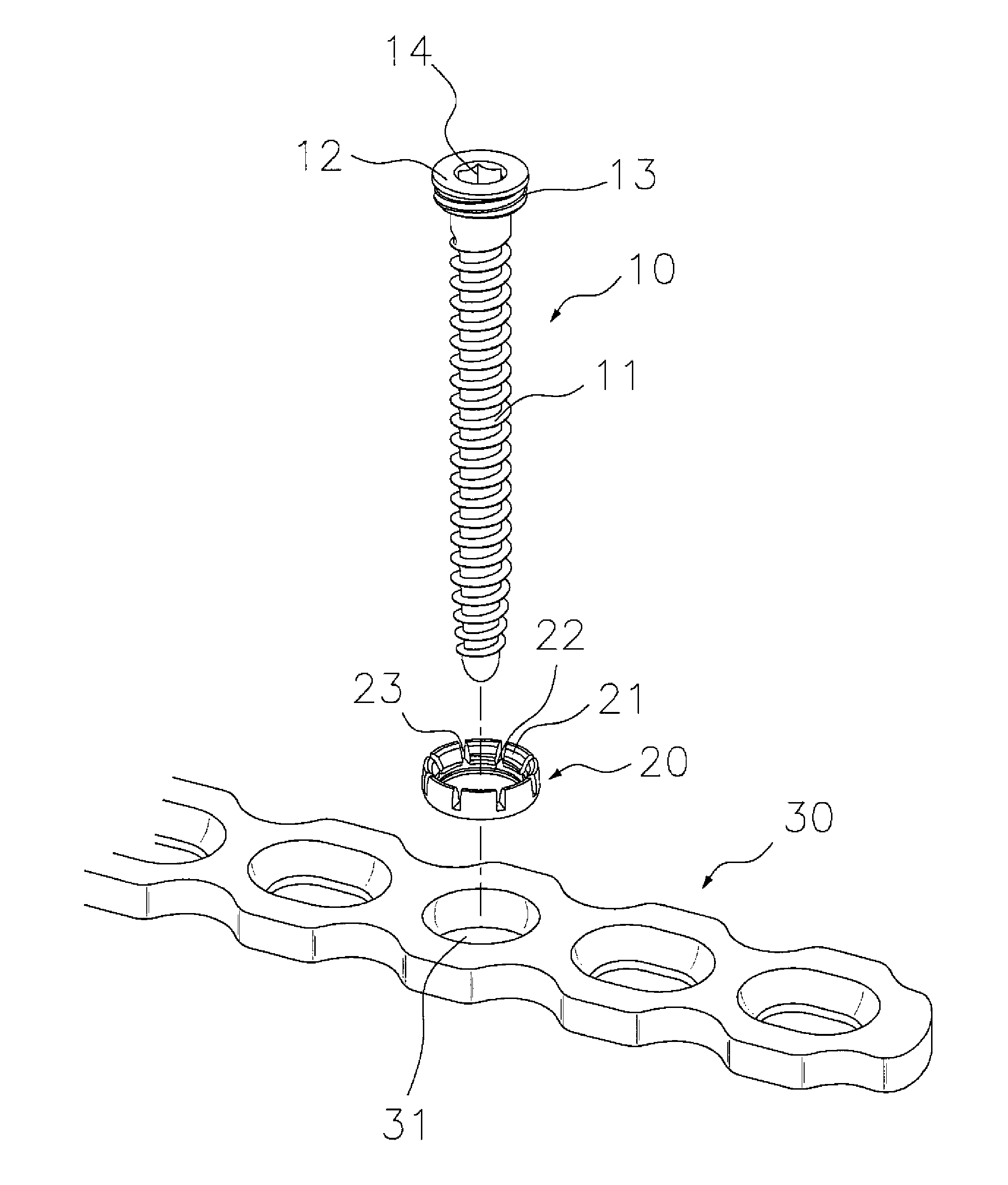 Apparatus for bone fixation