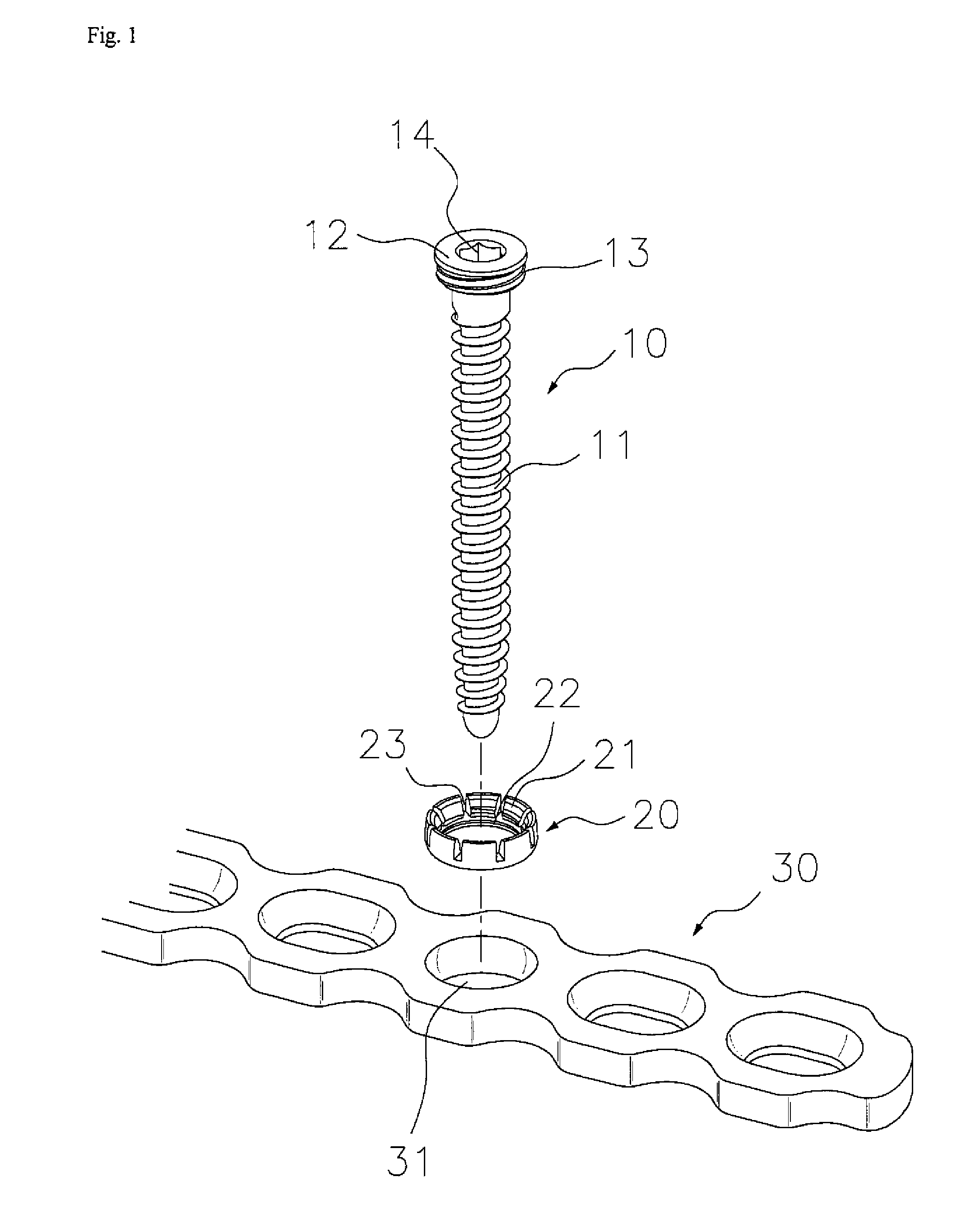 Apparatus for bone fixation