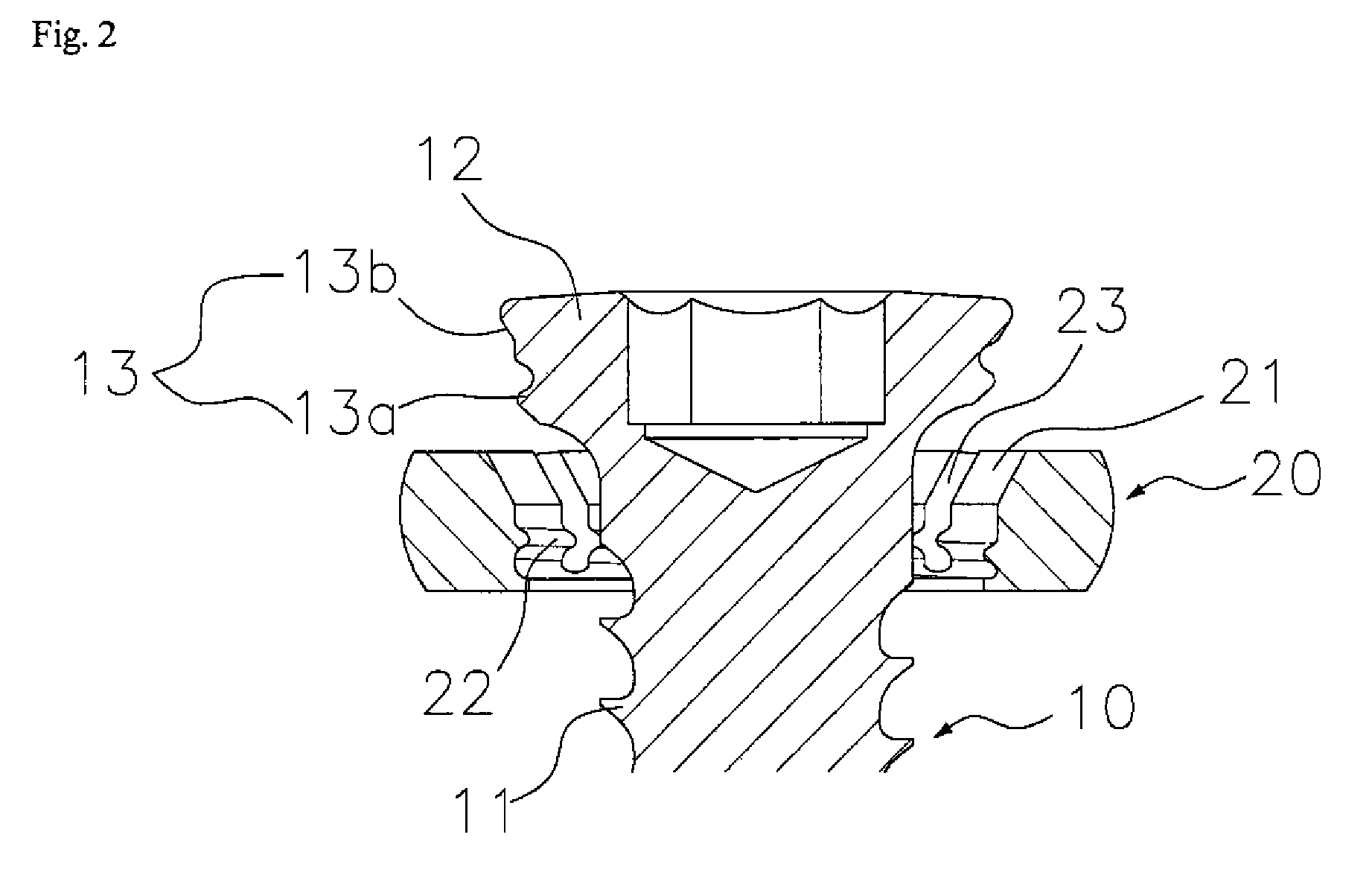 Apparatus for bone fixation