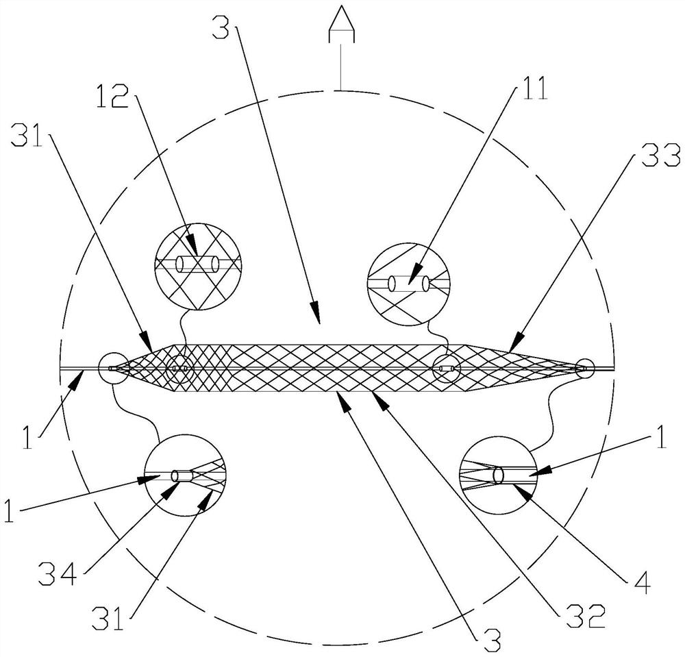 Multifunctional thrombus treatment device and use method thereof