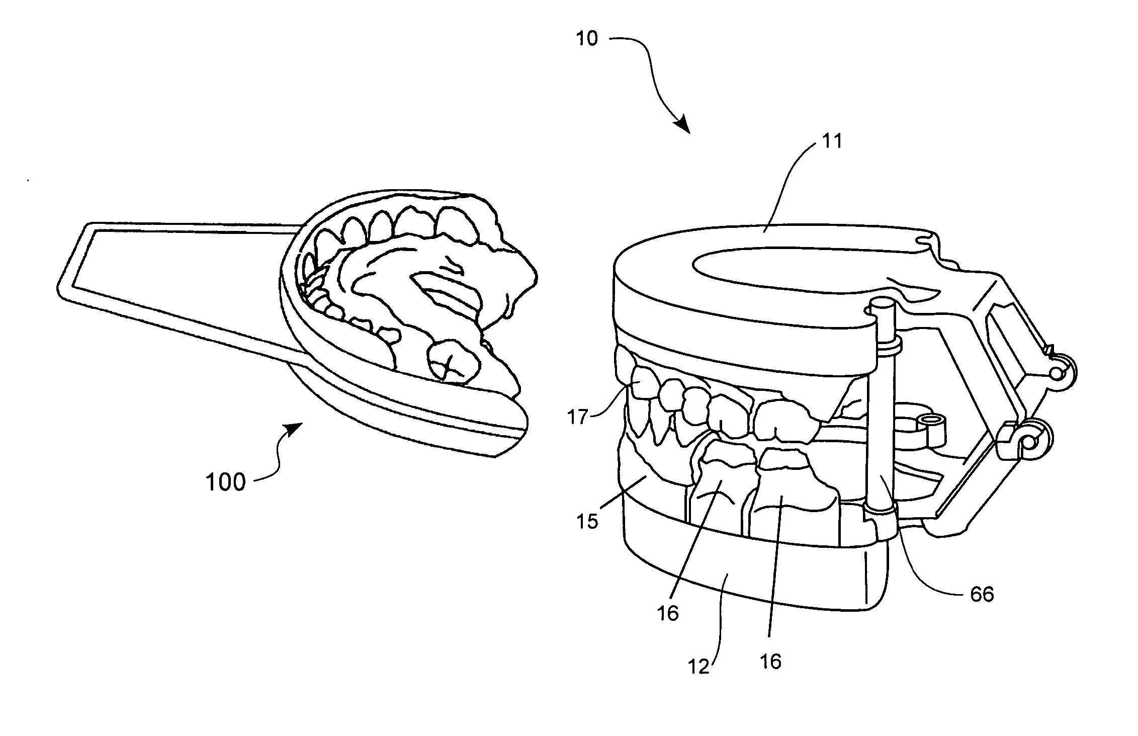 Dental modeling and articulating system and method