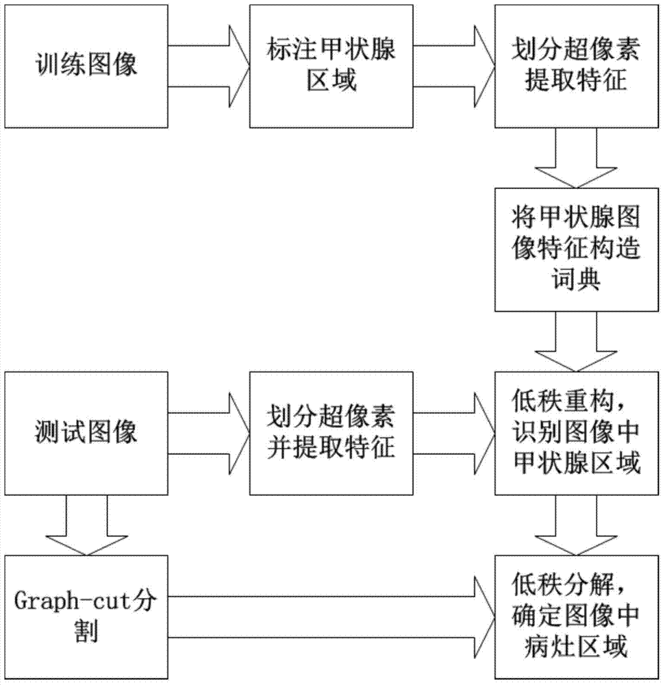 An image recognition method for thyroid lesions based on low-rank analysis of ultrasound images