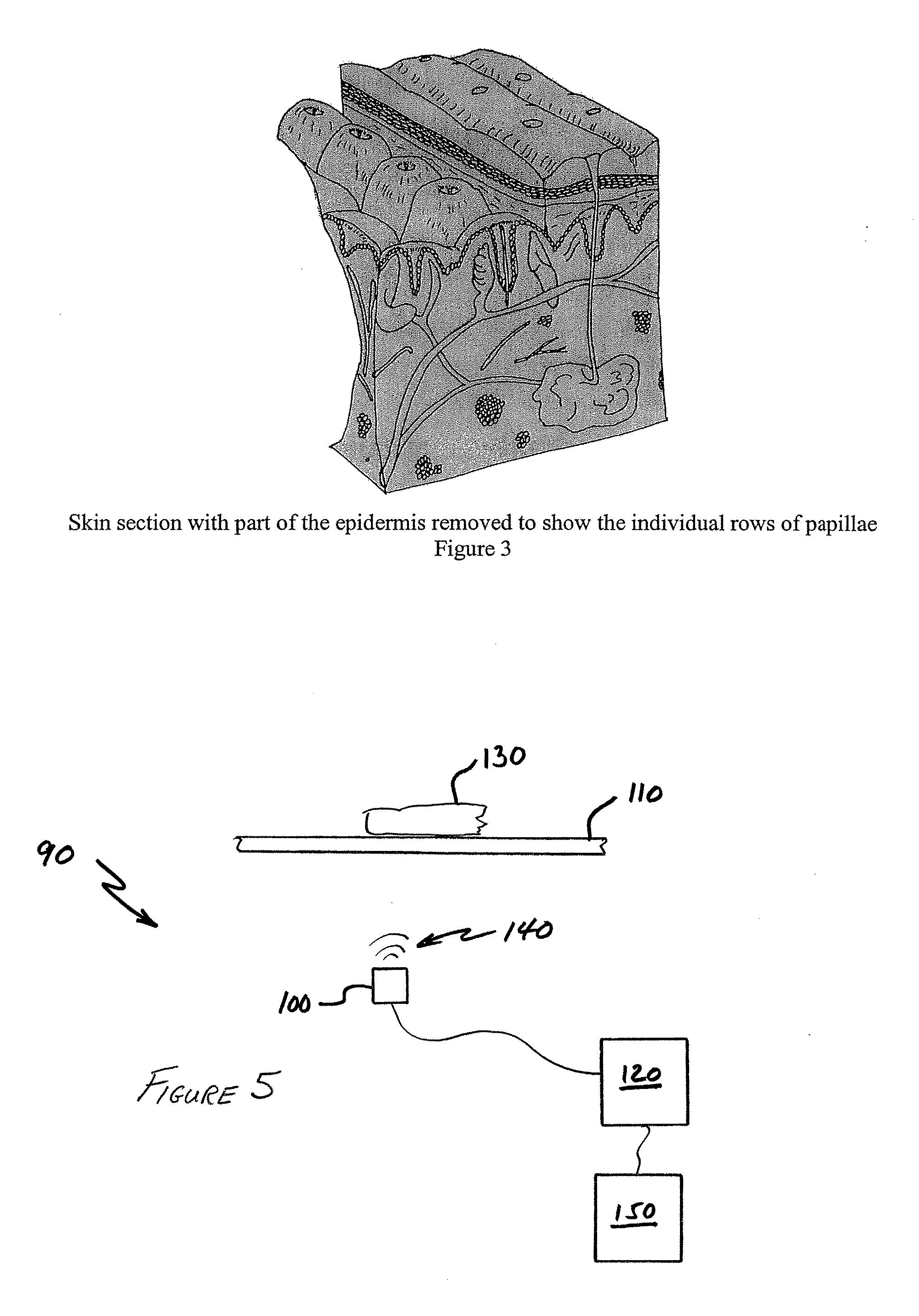 Use Of Papilla Mapping To Determine A Friction-Ridge Surface