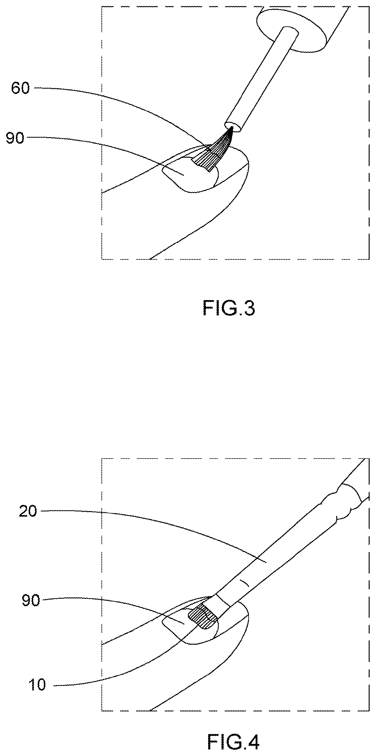 Artificial nail tip and curing composition set and applying method thereof