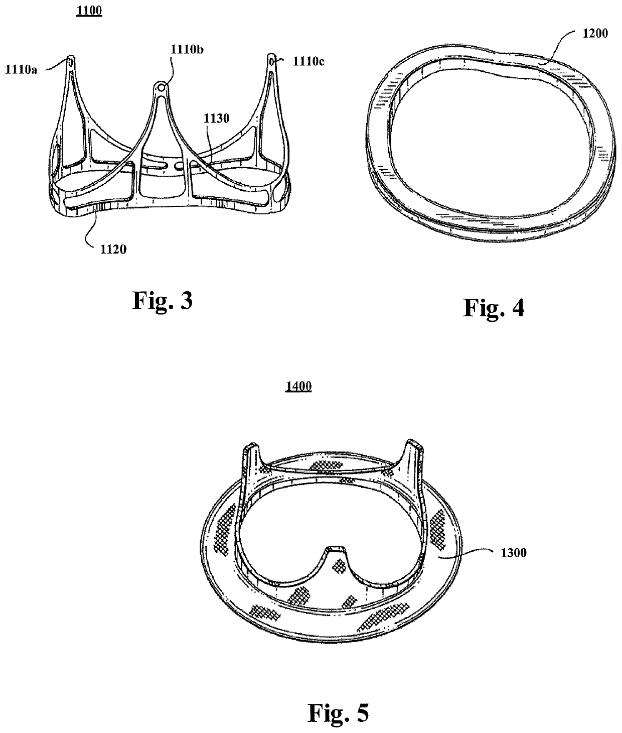 Tethering System For A Prosthetic Heart Valve