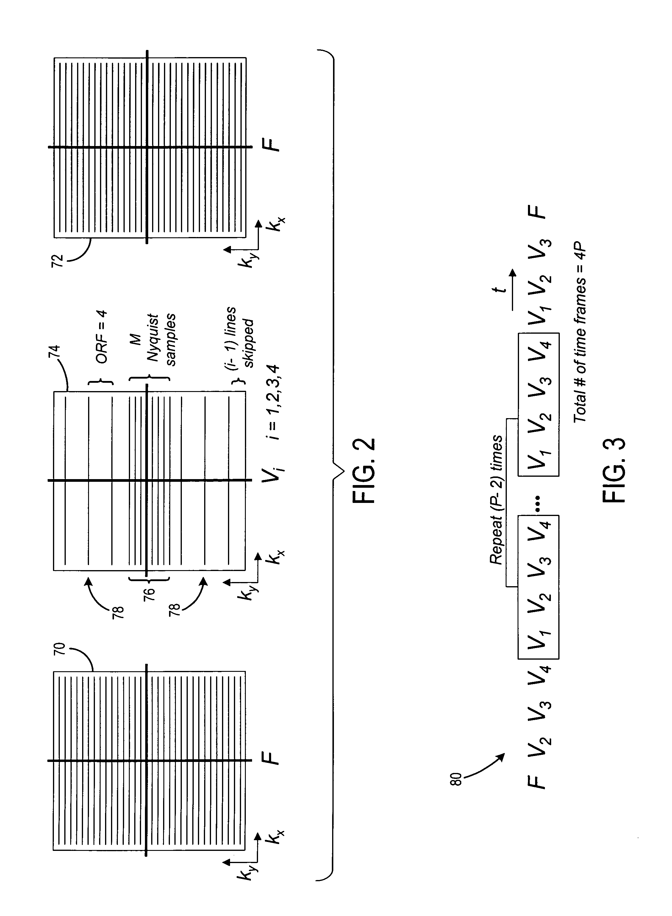 Hybrid k-t method of dynamic imaging with improved spatiotemporal resolution