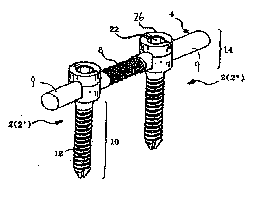 Spinal stabilization device