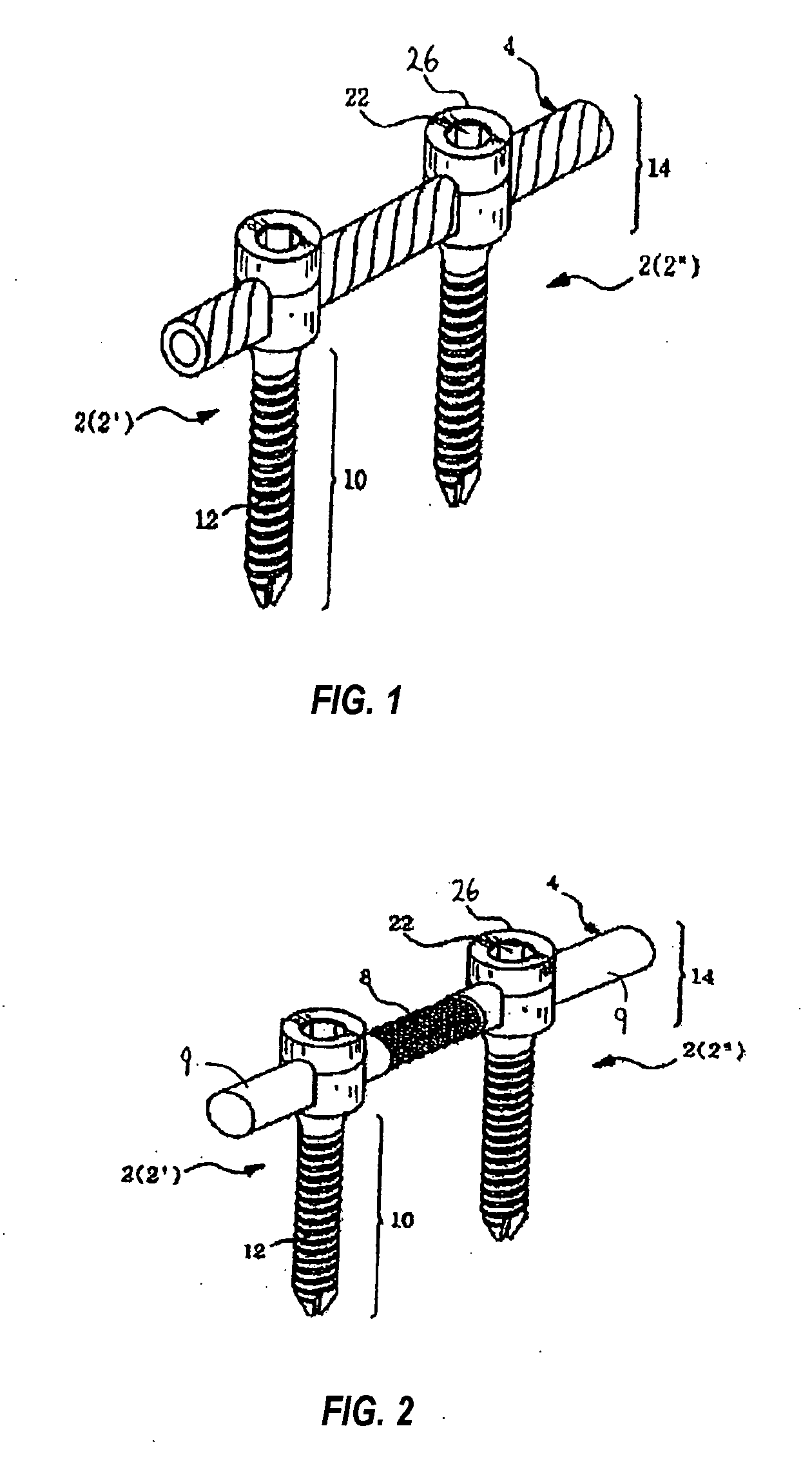 Spinal stabilization device