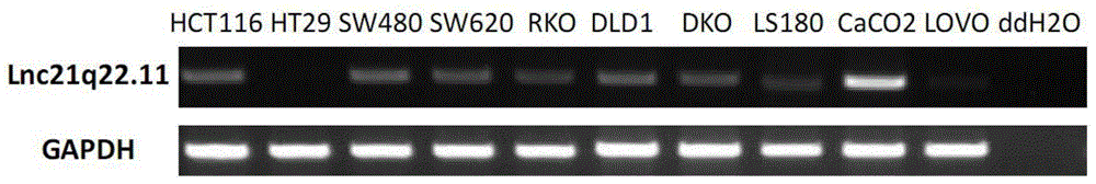 Long noncoding RNA (LncRNA), and primer pair and kit for detecting expression level of long noncoding RNA in cells and tissues