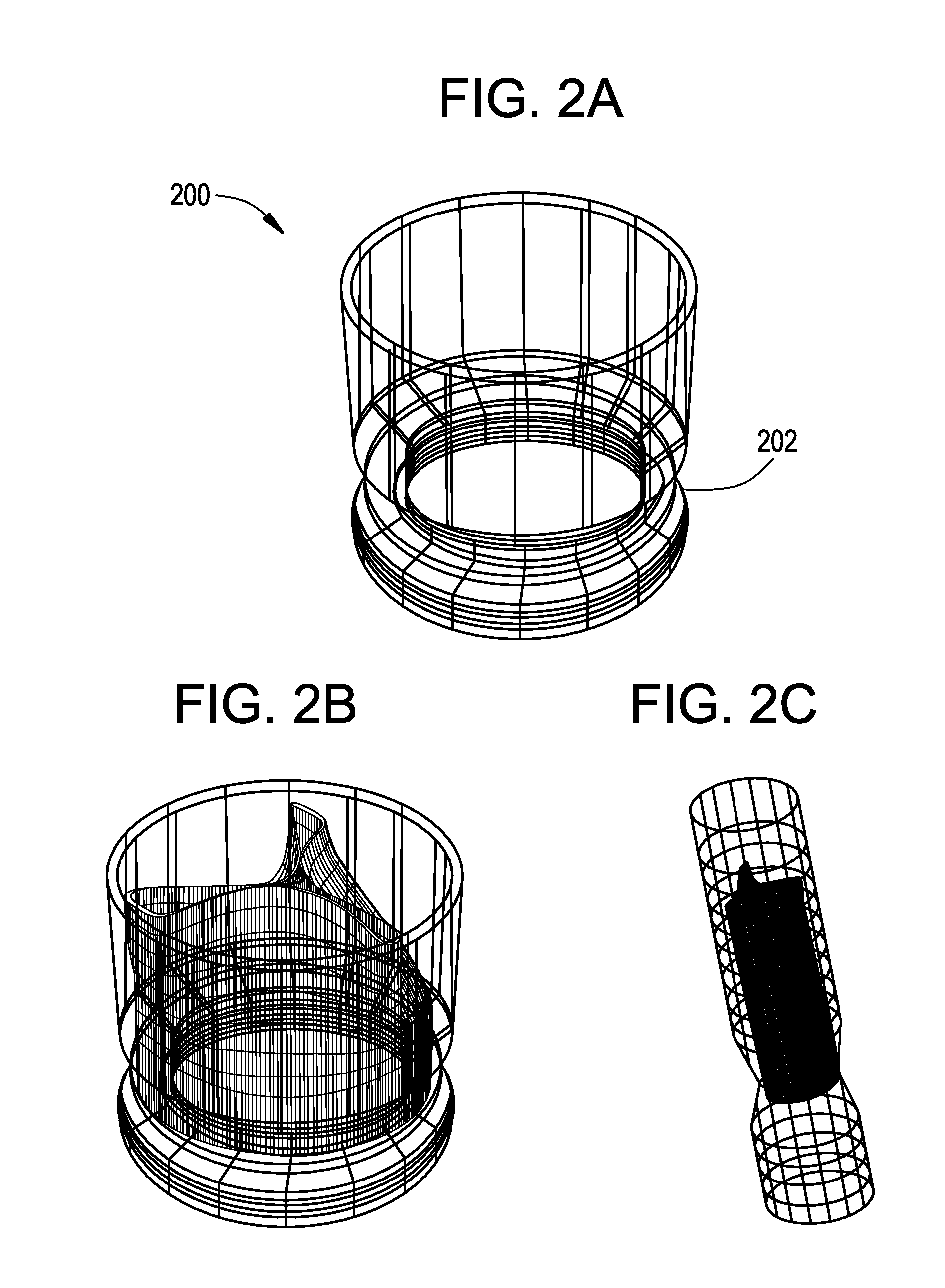 Stent-valves for valve replacement and associated methods and systems for surgery