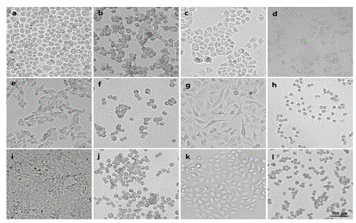 Myxobacteria strain and antitumor activity metabolite thereof