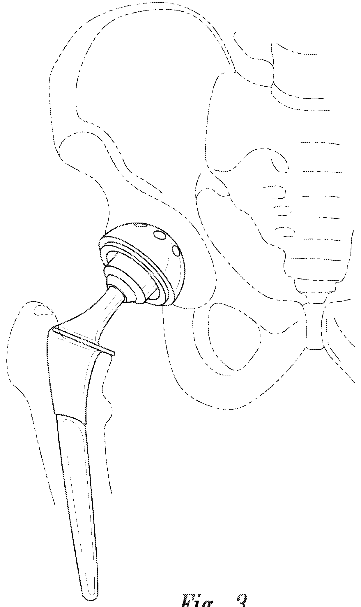 Devices, systems and methods for monitoring hip replacements