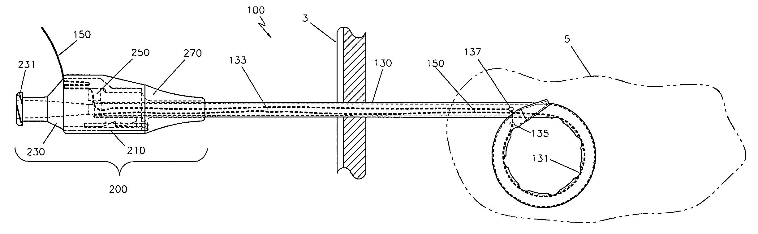 Locking catheter hub