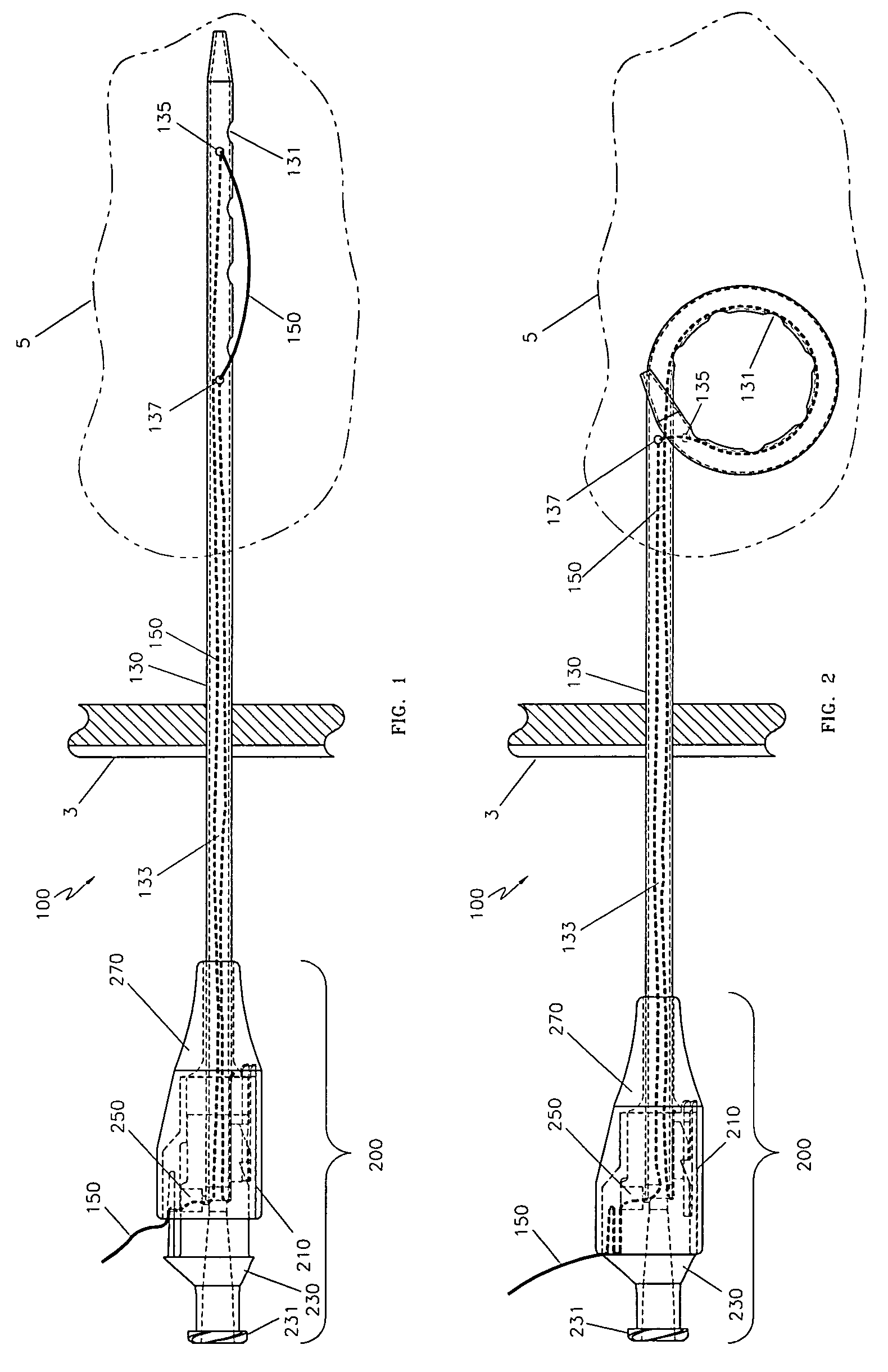 Locking catheter hub