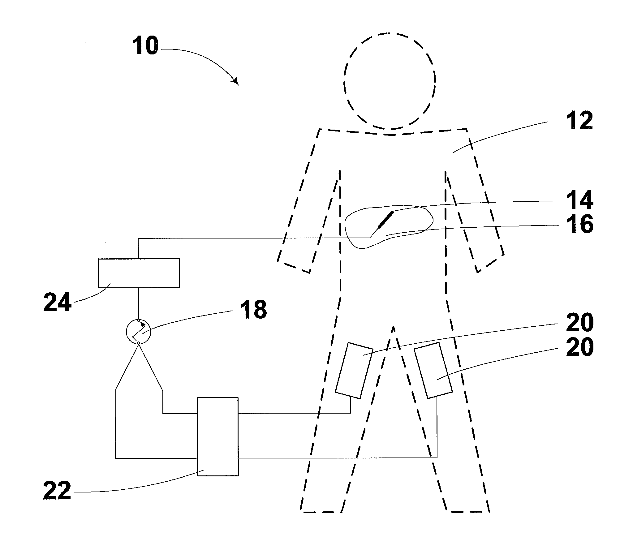 Radiofrequency ablation device for reducing the incidence of skin burns