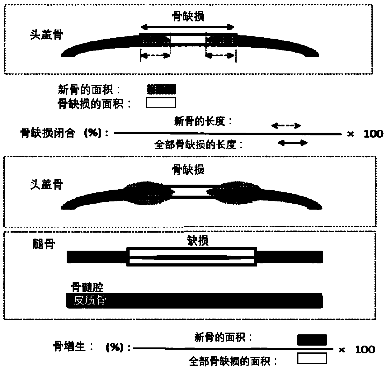 Absorbable membrane, preparation method and application of absorbable membrane and dental implant