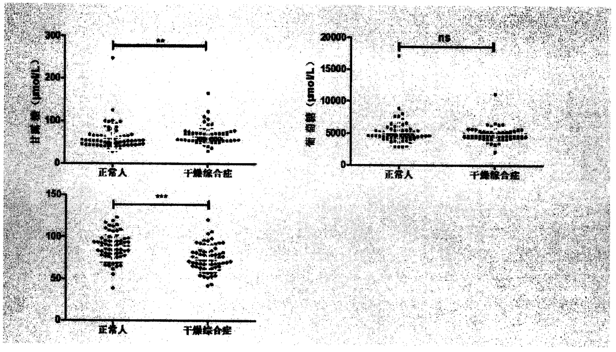 Method of biomarker for identifying sjogren syndrome and detection kit for identifying sjogren syndrome