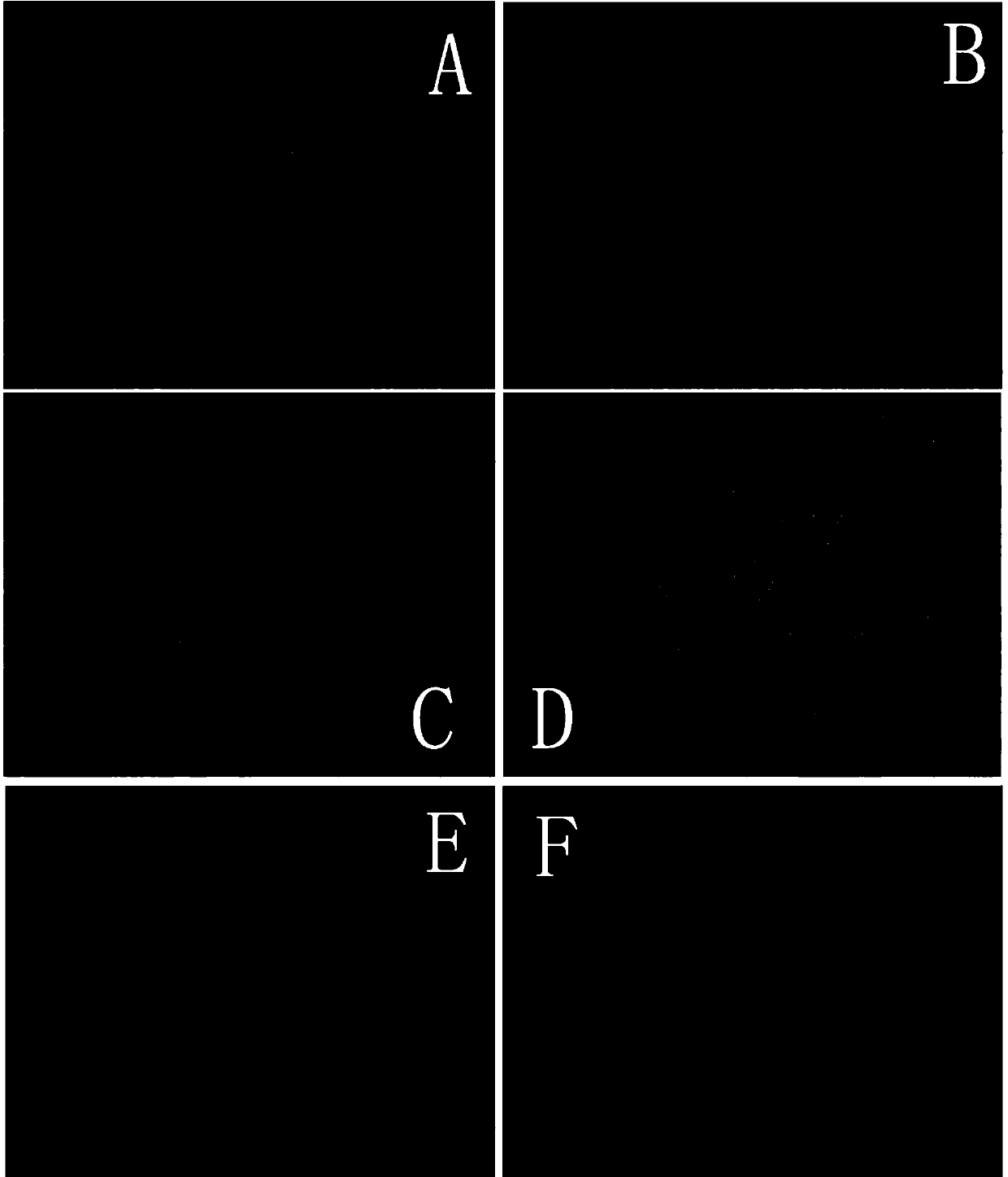 Traditional Chinese medicine hydrogel patch capable of treating chemotherapeutic phlebitis, and preparation method thereof