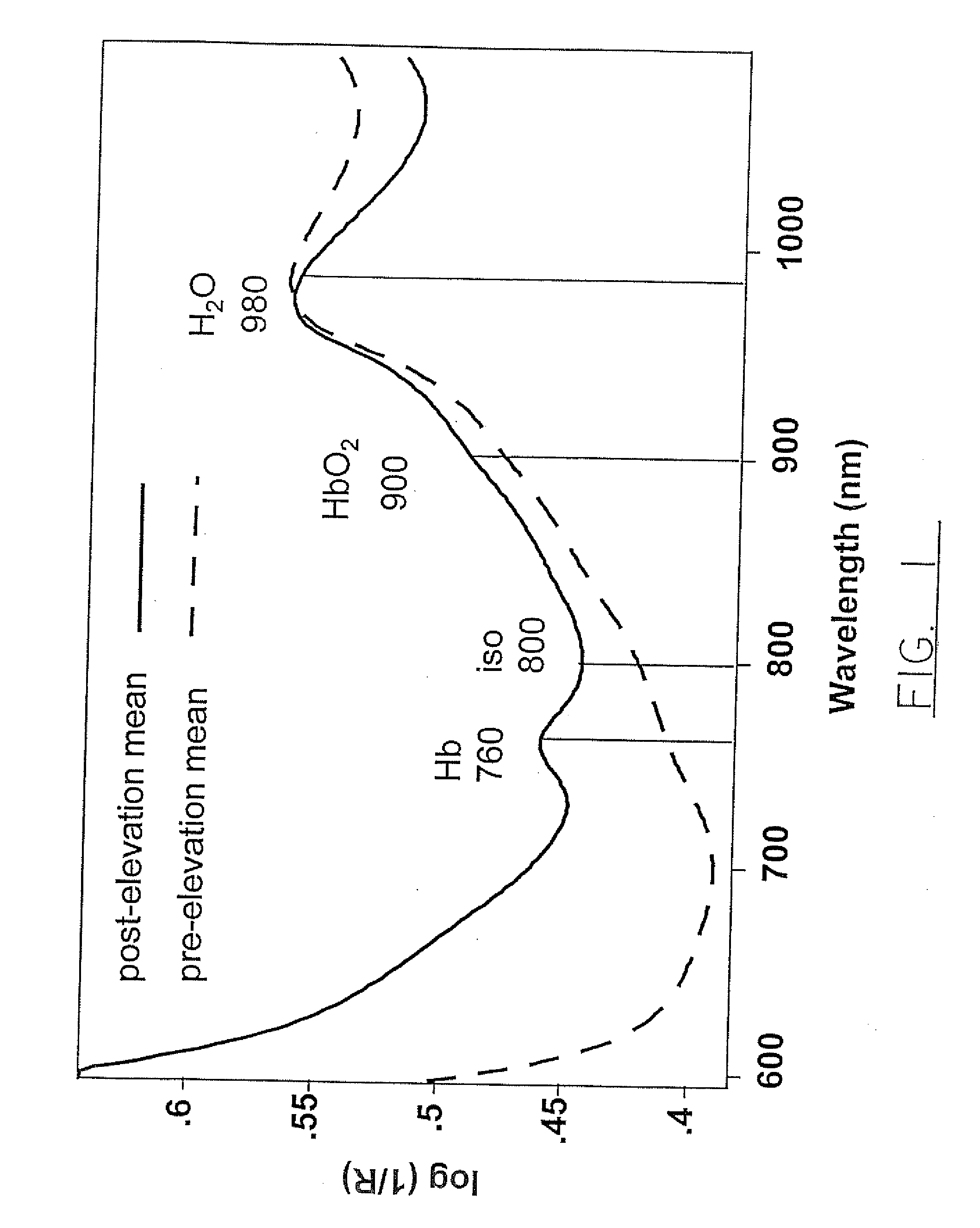 Method of assessing tissue viability using near-infrared spectroscopy