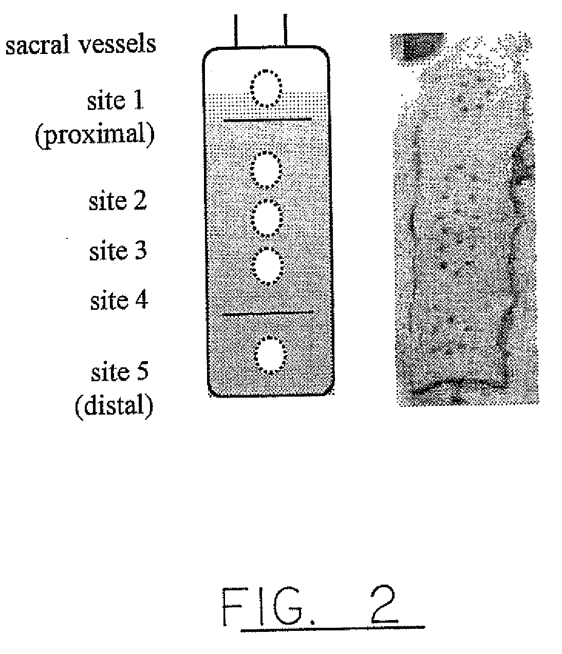 Method of assessing tissue viability using near-infrared spectroscopy