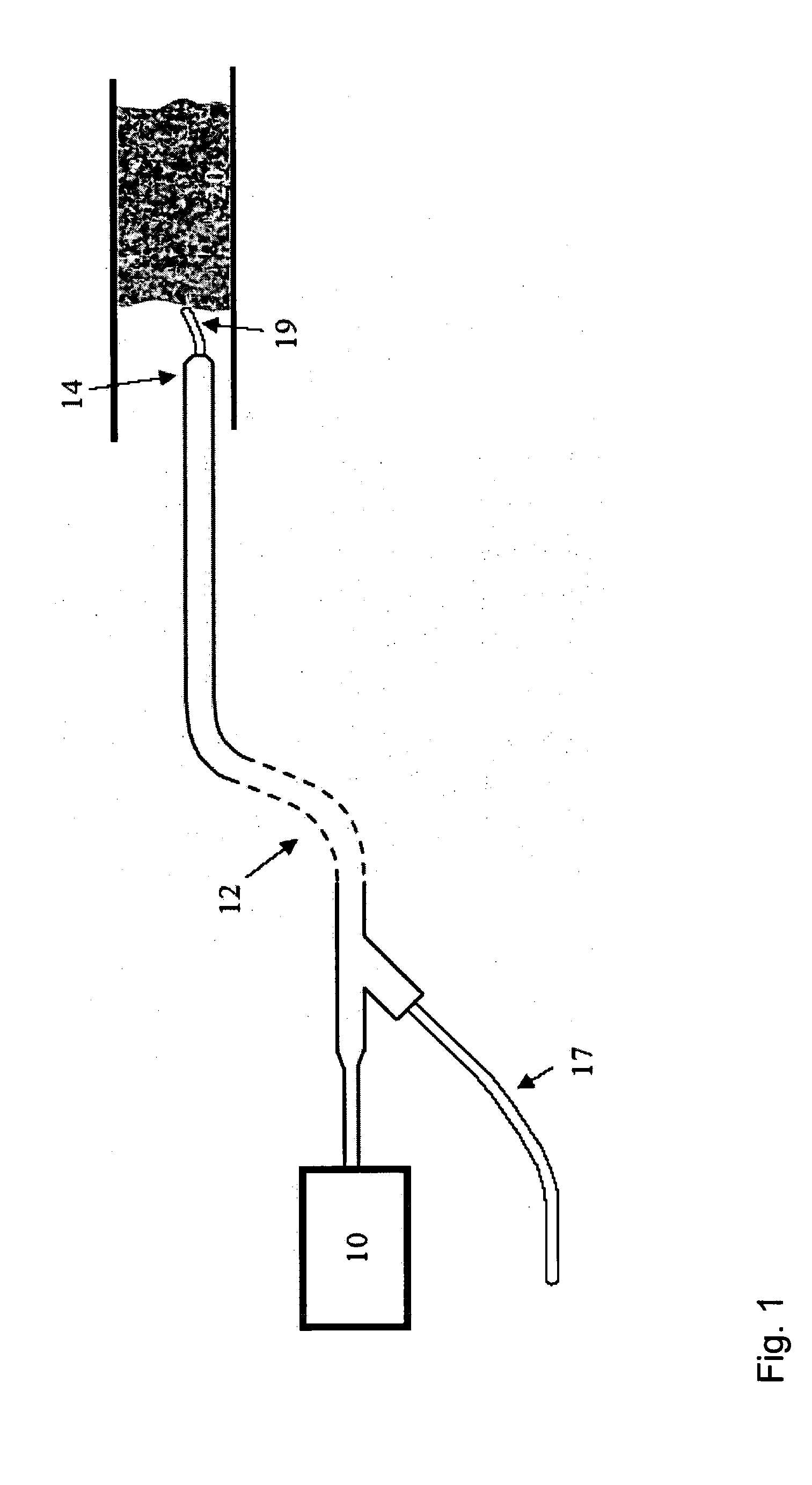 Image-guided laser catheter