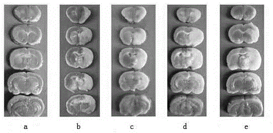 Freeze-dried powder for treating focal cerebral ischemia reperfusion inflammation reaction and preparation method thereof