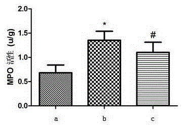 Freeze-dried powder for treating focal cerebral ischemia reperfusion inflammation reaction and preparation method thereof