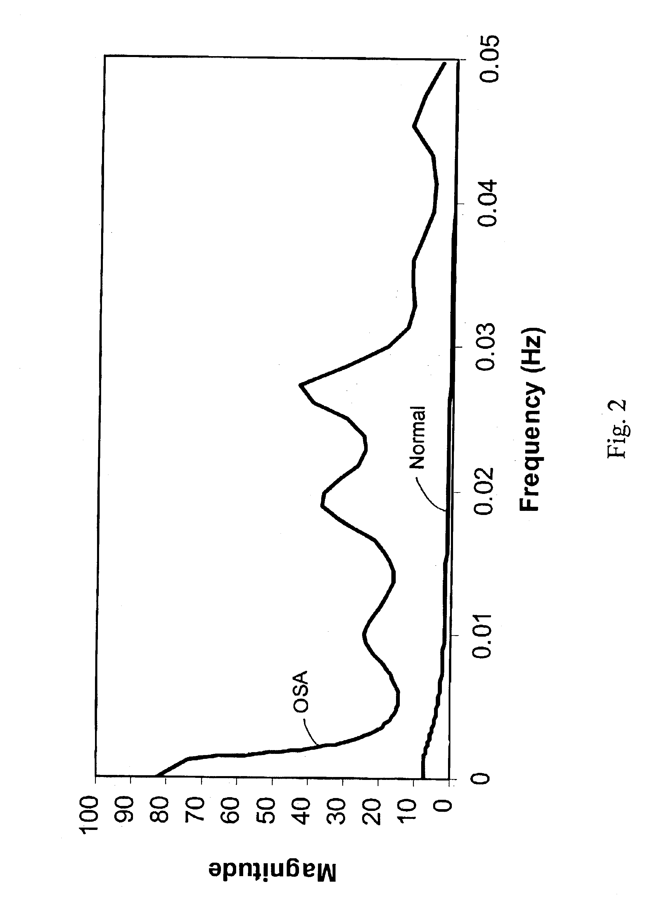 Method for detecting Cheyne-Stokes respiration in patients with congestive heart failure