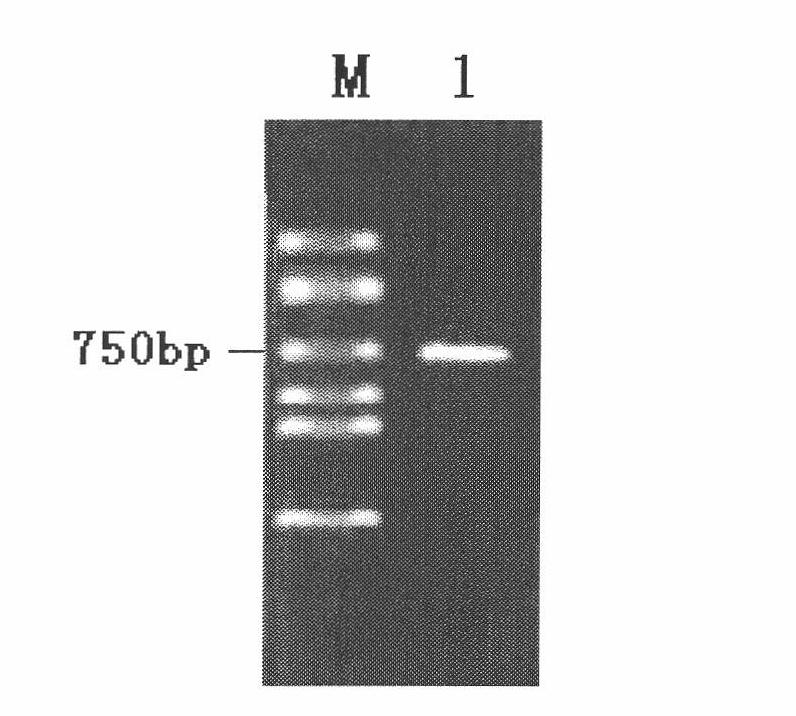 Immune-enhanced hepatitis B therapeutic multivalent vaccine and preparation method thereof