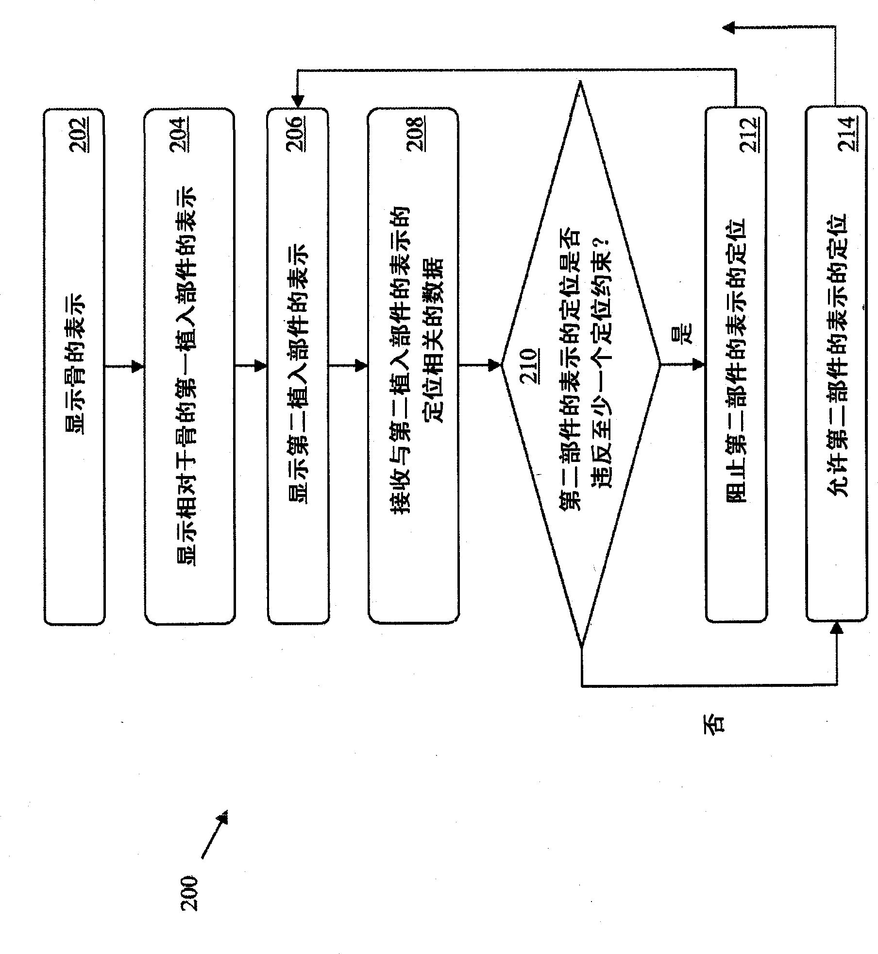 Implant Planning Using Areas Representing Cartilage