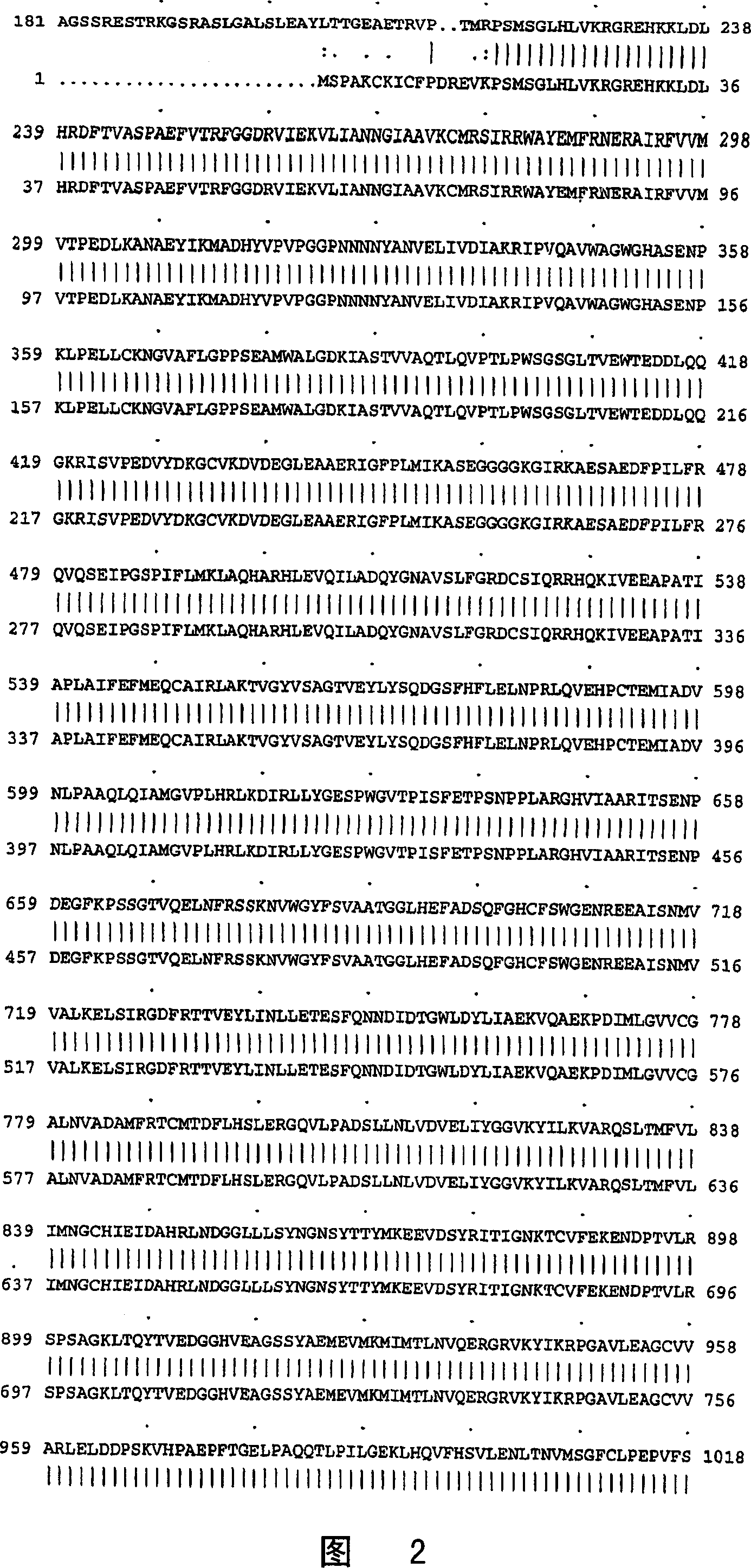 Acetyl CoA carboxylase splice variant and uses thereof