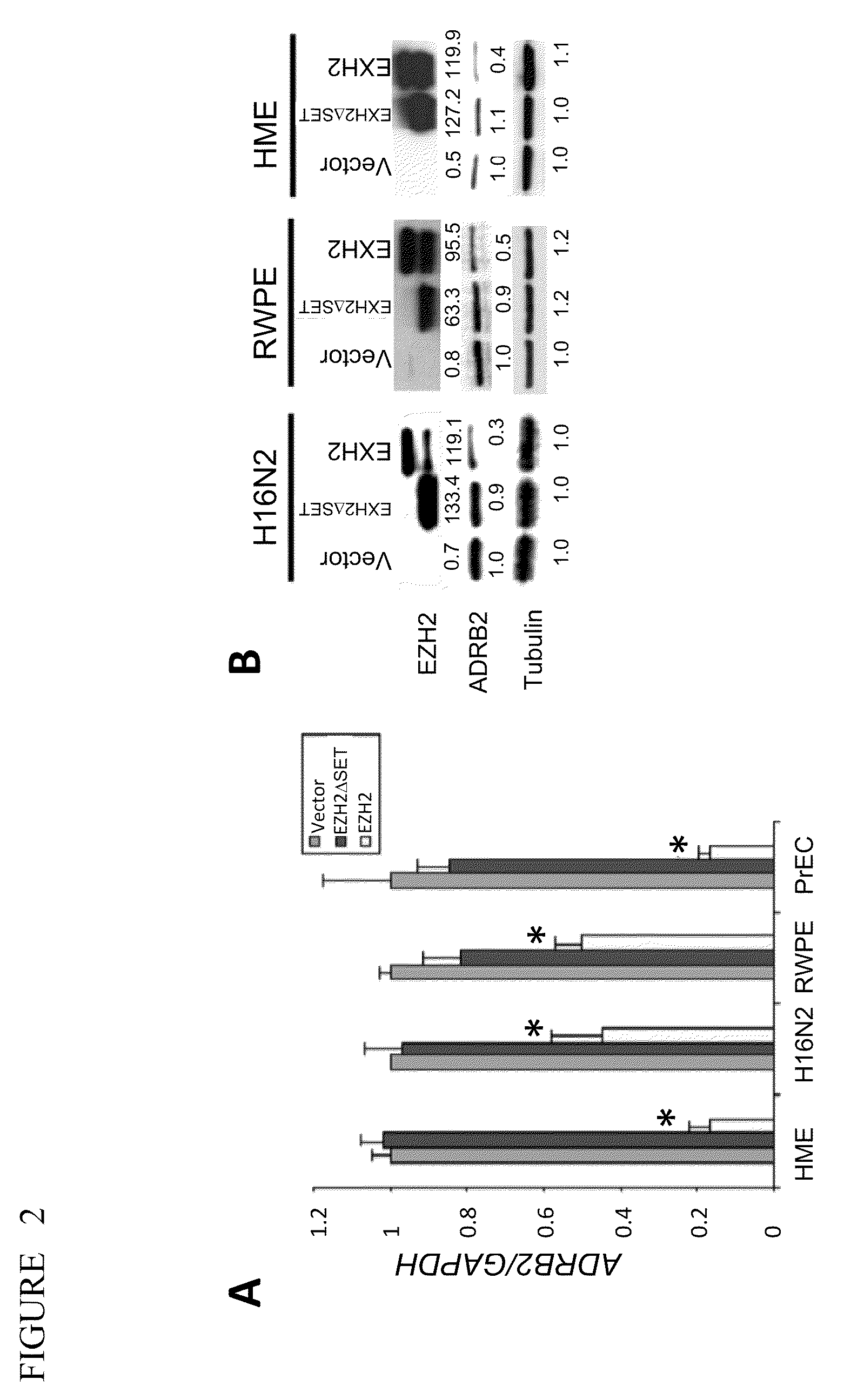 Adrb2 cancer markers