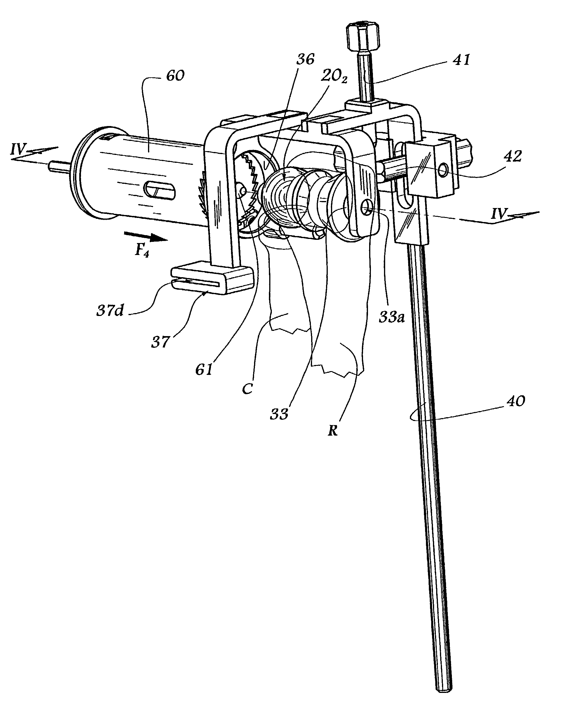 Ancillary tool for fitting an ulnar component and/or a radial component of an elbow prosthesis