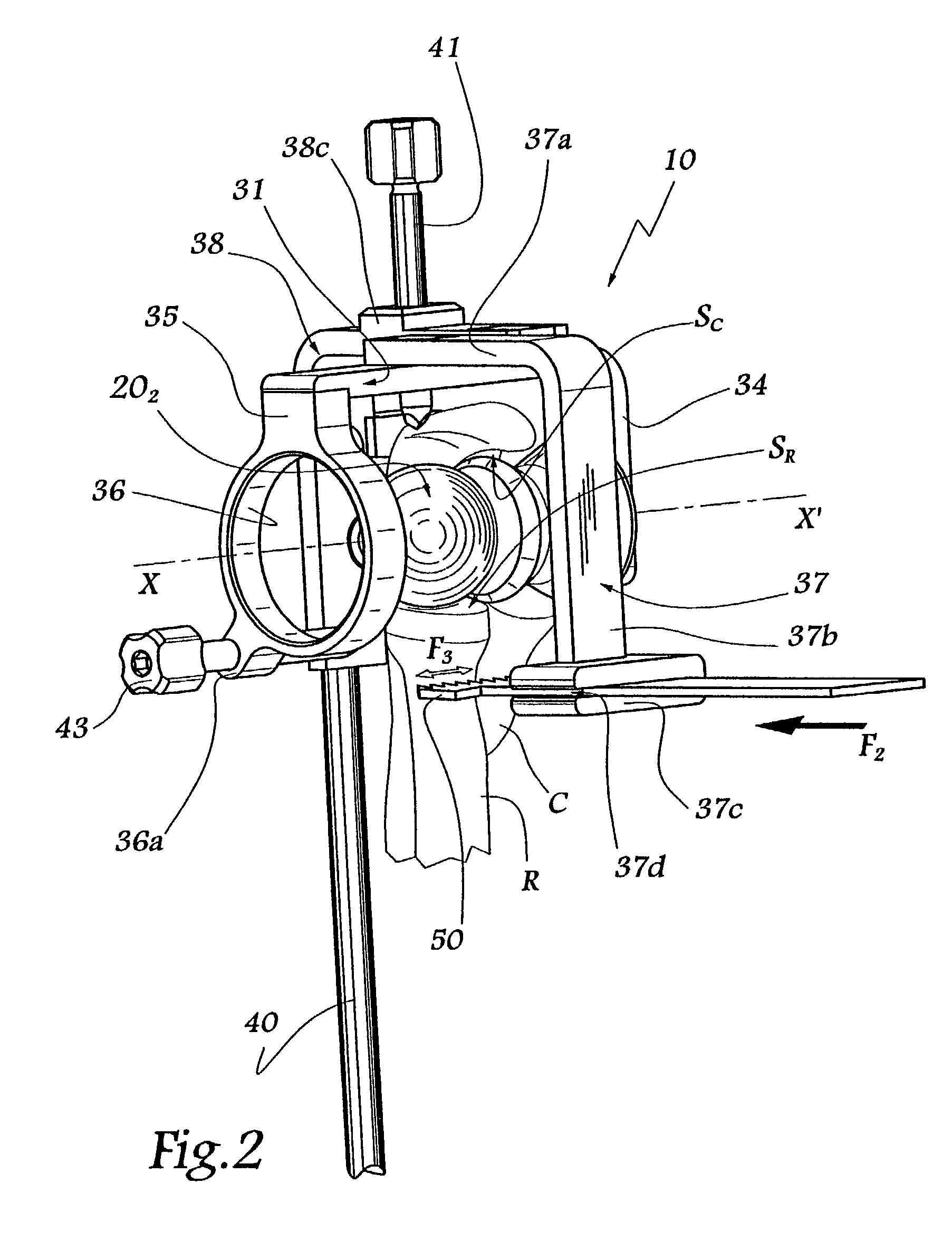 Ancillary tool for fitting an ulnar component and/or a radial component of an elbow prosthesis