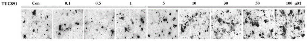 Application of gpr120 agonist tug891 in prevention and treatment of osteoporosis