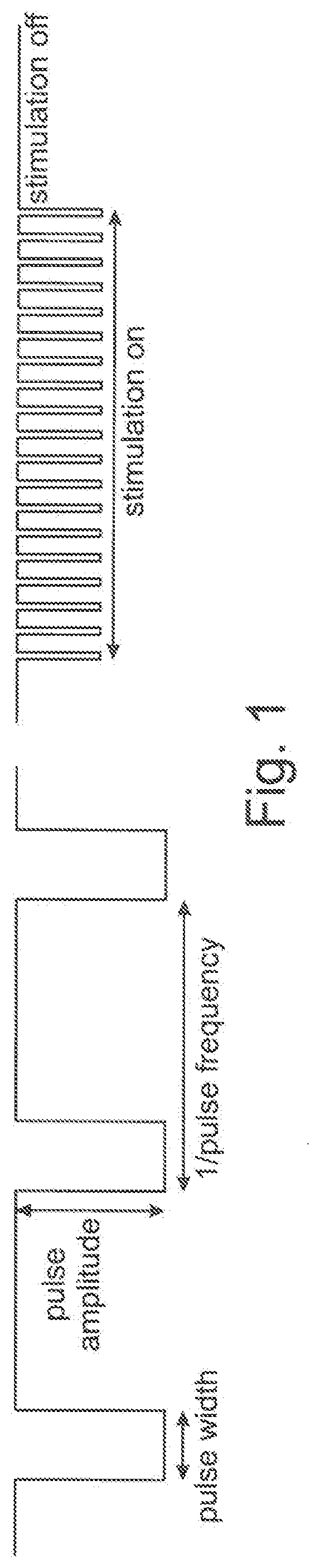 Sensor in clothing of limbs or footwear