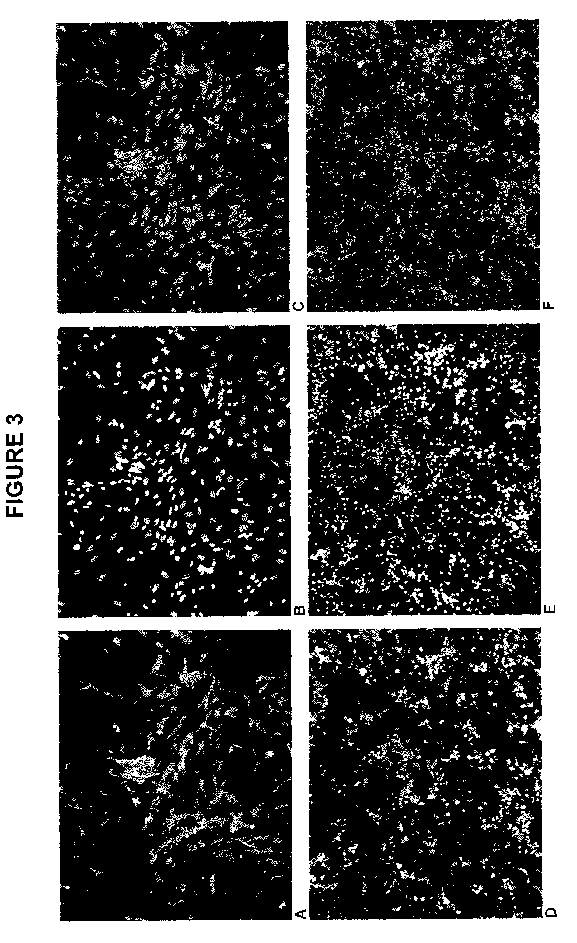 Methods of derivation of neuronal progenitor cells from embryonic stem cells